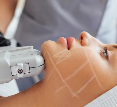 HIFU Facial