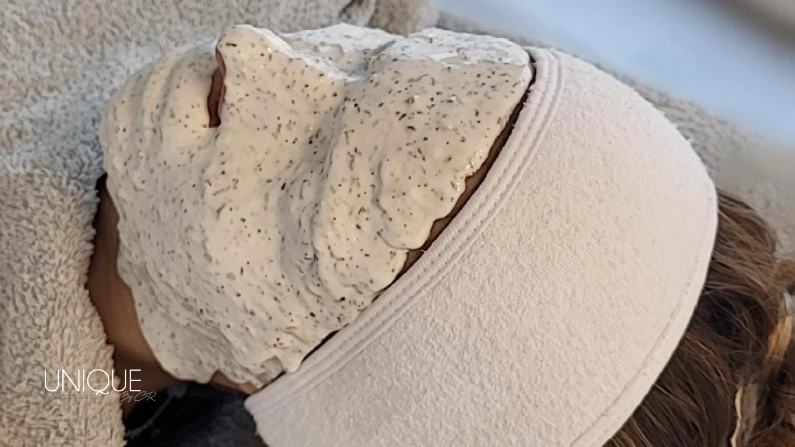 O Poder do Laser Vascular na Estética e na Saúde