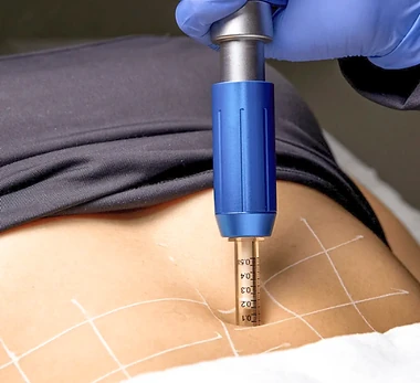 Mesoterapia Pressurizada