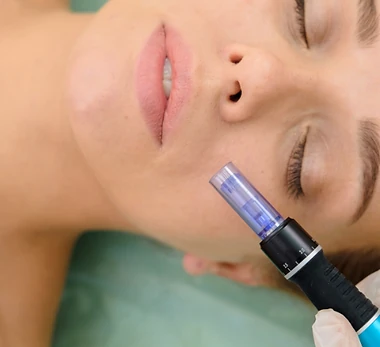 Microagulhamento Facial